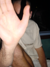 Dean's hand